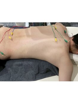 鍼灸施術を受けたい