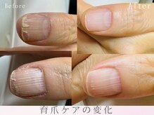ケアビューティサロン(care beauty salon)/育爪ケア