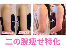 ミント(Mint)の雰囲気（本気で痩身したい方へ。特化技術で“細い”二の腕叶えます！）