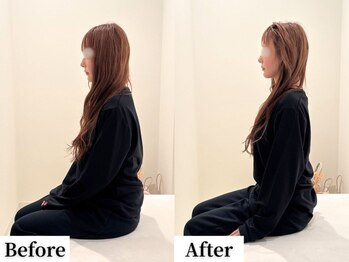 ソレア(Solea)/肩甲骨改善