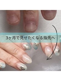 爪噛み　爪育成　岐阜　笠松