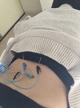 瑞 鍼灸院/オプション　腰痛鍼灸