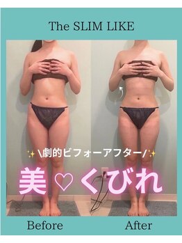 スリムライク 鳥取店(The SLIM LIKE)/痩身ビフォーアフター