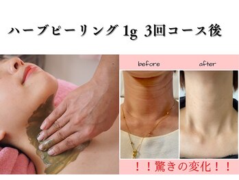 小顔専門サロン ラリューシュ(La ruche)/最短で結果だしサロン