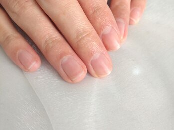 【田島】ハンドケア