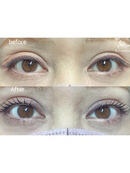 まつげのお悩み解決サロン