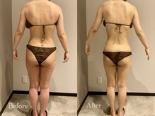 エステティック ミュー(Esthetic MiEUX)/全身痩せコース5回目