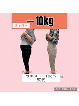 ヴェリテ(Verite)/before after