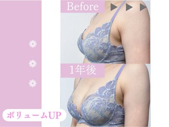 キアナ 横浜店(Kiana)/平均2～3カップUP続出