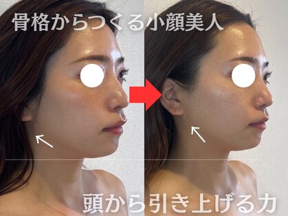 エレミュー(Elemue)の写真