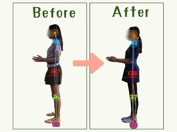 【痩身/ダイエット/整体/骨盤矯正】専門サロン アテオス/10代 膝の痛み・腰痛・頭痛
