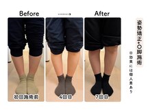 ルリアン骨盤小顔整体院 横浜/before/after