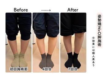 ルリアン骨盤小顔整体院 横浜/before/after