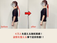 プレーバ(Preava)/4万人を超える施術実績！