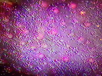 ビップルーム バイ パルティール(VIP ROOM by Partir)/肌内診断