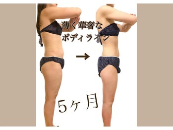 ウェリナポノビューティサロン(welina pono beauty salon)/《痩身/ダイエット/小顔》