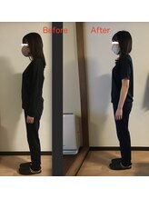 ボディラボカワサキ(Body Labo Kawasaki)/ビフォアフター　約3ヶ月後