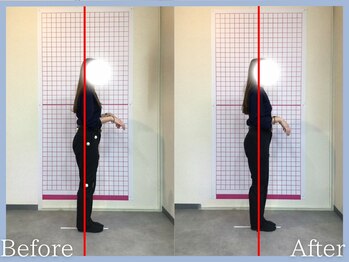 トロ整骨院(toro整骨院)/矯正×EMS(1回)20代女性