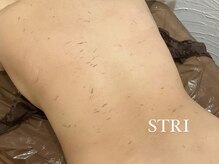 ストリ(STRI)/垢すり施術