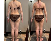 モモリラ(momorila)/活性リンパ洗浄