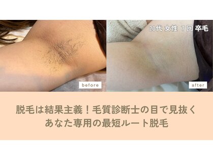 ビーディーラボ(B.D.Labo)の写真