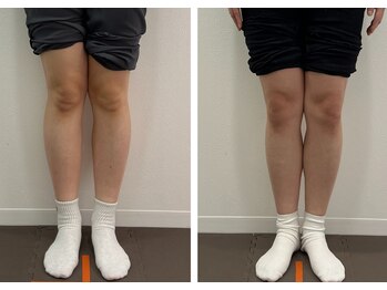 なおちゃん整骨院 整体院/X脚矯正