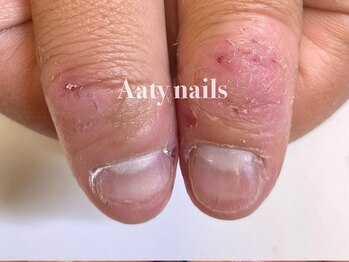 アーティネイルズ(Aaty Nails)の写真/当店の80％はネイルサロン初めての方！隣との仕切りもあるので視線も気にならない♪メンズも可◎