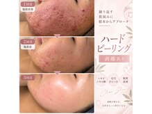 リアン(lien)の雰囲気（お肌に合った施術で素肌美人に♪毛穴洗浄やハーブピーリングなど）