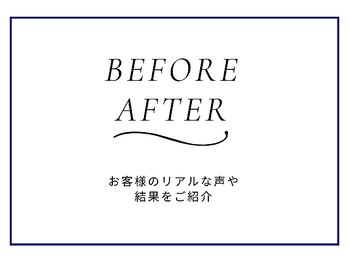 ニキビケア研究所 横浜店/BEFORE AFTER