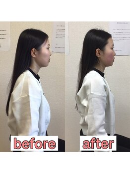 オズ六本木/姿勢も良くなる小顔整体