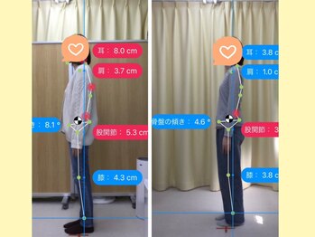 ナオル整体 春日部院(NAORU整体)/春日部/整体/姿勢矯正/猫背矯正