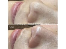 ピエル 北千住店(PIEL)/施術後の見た目の変化