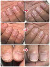 ユキネイル(YUKINAIL)/メンズ／ハンドケア