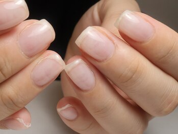 クロ(KURO)/自爪育成/柳津ネイルサロン