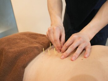 アラキ(ARAKI)/腰痛・肩こりには「鍼施術」!