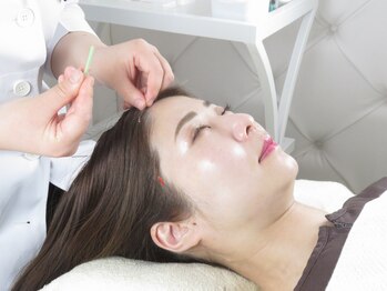 アキュモンド 渋谷院(acumond)/鍼の施術中