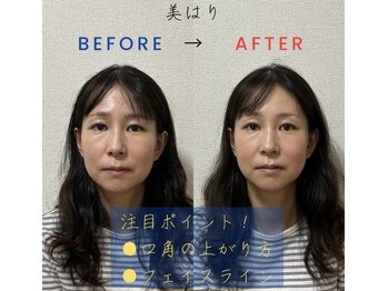 高松市なつめ鍼灸整体院