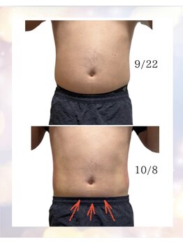 ルナ(LUNA)/男性Before After♪