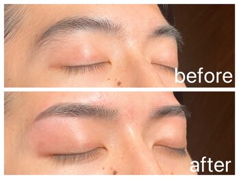 クラシックス(CLASSICS)/メンズワックス脱毛