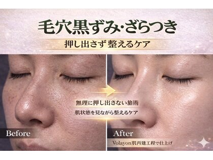 ワイズデュー(Y's Dew)の写真