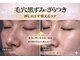ワイズデュー(Y's Dew)の写真