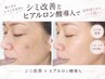 シミ改善とシワ・たるみケアのヒアルロン酸導入セラピー　￥16,940→￥10,000