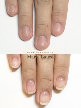 マリーロール 梅田店(Marie Laure)/自爪育成/深爪矯正/ネイルケア