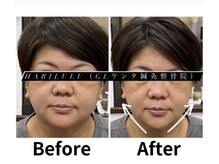 ハリルル 併設 GLケンタ鍼灸整骨院(HARILULU)/ヘッドHARI×ドライヘッドスパ