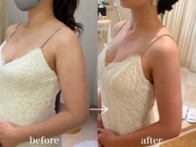 クイーンズ ピュア 恵比寿店(Queen's Pure)/二の腕シェイプ