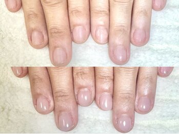 グラシナ なんば店/深爪/自爪育成/フィルイン