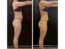 ウィンウィン 新山口店(Win Win)/ブライダルのお客様