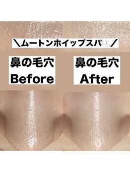ポワールムース(POIRE mousse)/Before&After写真☆