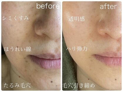 ルミエール フォレストサイド(L’MIERE forestside)の写真