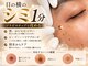 フルール(Fleur.)の写真/40代からの頑固なシミ＆シワに◎那覇初導入【韓国発プラズマ×臍帯血成分】年齢肌をケア。那覇市おもろまち